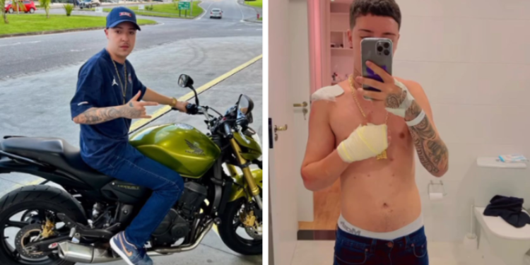 Salvador sofre acidente após tentar empinar moto