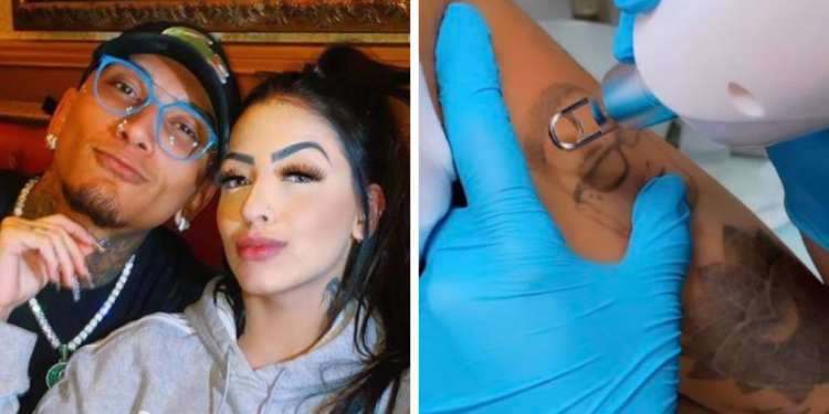 MC Mirella aparece removendo a tatuagem que tem do rosto de Dynho Alves; veja