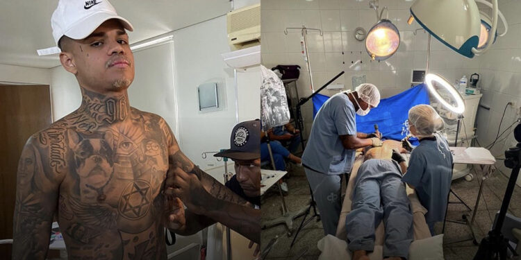 MC Cabelinho toma anestesia geral para fazer tatuagem